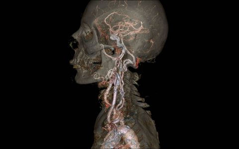 核磁共振成像（MRI）下的人类行为研究