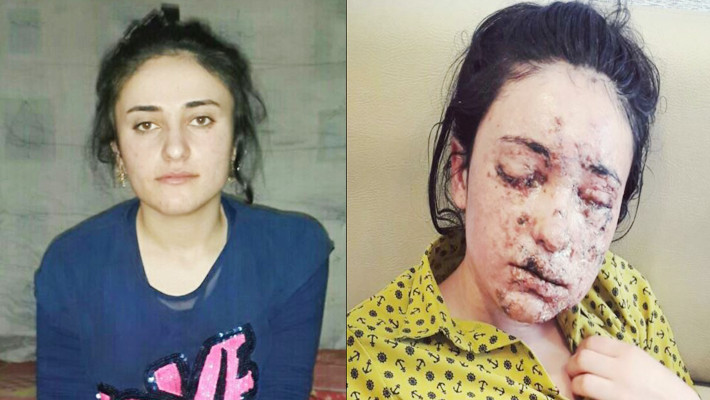 16岁被IS日夜强暴沦性奴，逃到医院后主任伸出手…再次侵犯她