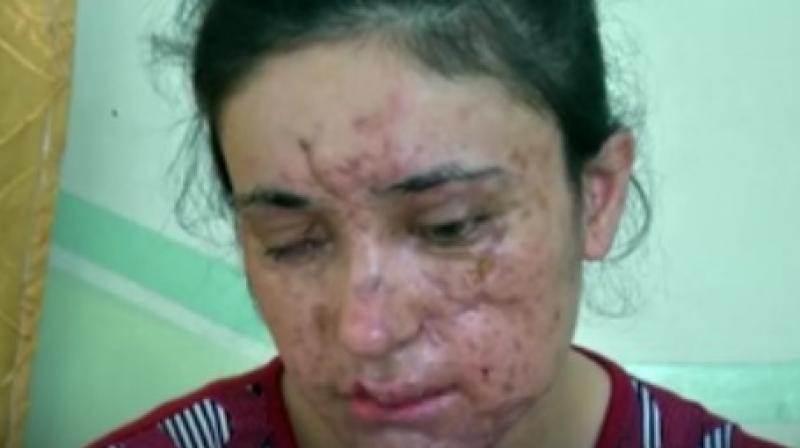 6岁被IS日夜强暴沦性奴，逃到医院后主任伸出手…再次侵犯她"