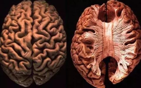 大脑和脊髓标本 ​​​​