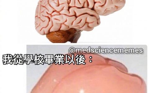 我的脑子可能比德芙还要丝滑