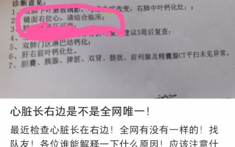 这就是主角光环吧