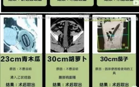 就TM离谱