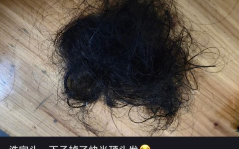 啊？？？？头发还能这样掉的… ​​​